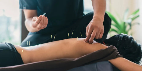 L’acupuncture : une solution naturelle aux maux de dos