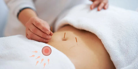 Acupuncture et fertilité : une approche naturelle