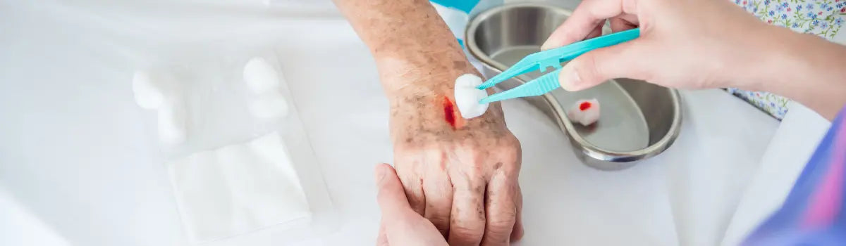 Fibrine : les cas particuliers