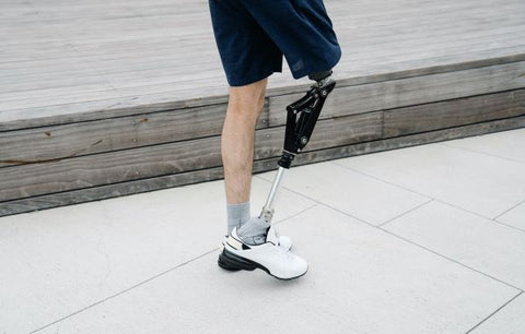 Homme debout qui a une de ses jambes amputée et remplacé par une prothèse